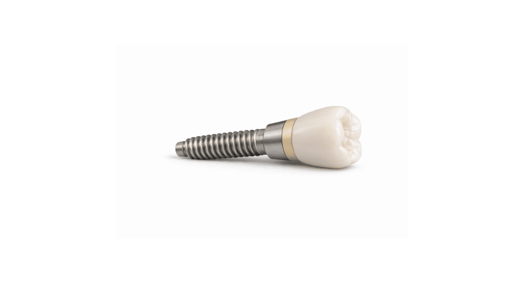 A single dental implant, crafted with precision using cnc machining in medical industry, features a metal screw and a white ceramic crown on a plain white background.